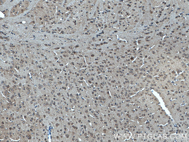 POFUT2 Antibody in Immunohistochemistry (Paraffin) (IHC (P))