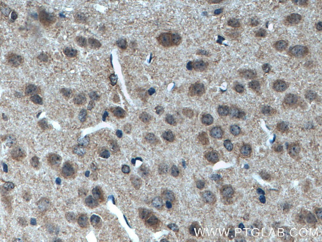 POFUT2 Antibody in Immunohistochemistry (Paraffin) (IHC (P))