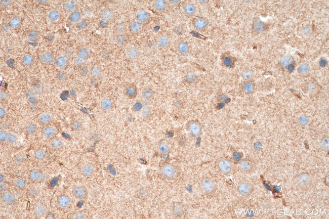 POFUT2 Antibody in Immunohistochemistry (Paraffin) (IHC (P))