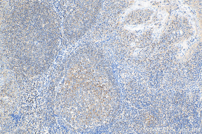 TLR3 Antibody in Immunohistochemistry (Paraffin) (IHC (P))