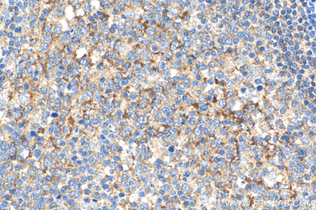 TLR3 Antibody in Immunohistochemistry (Paraffin) (IHC (P))