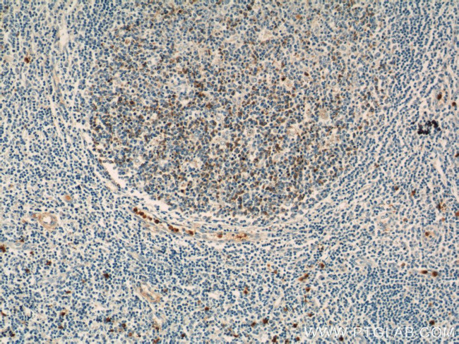 TLR3 Antibody in Immunohistochemistry (Paraffin) (IHC (P))