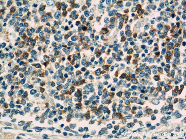 TLR3 Antibody in Immunohistochemistry (Paraffin) (IHC (P))