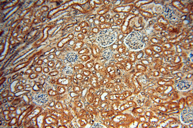 USP38 Antibody in Immunohistochemistry (Paraffin) (IHC (P))