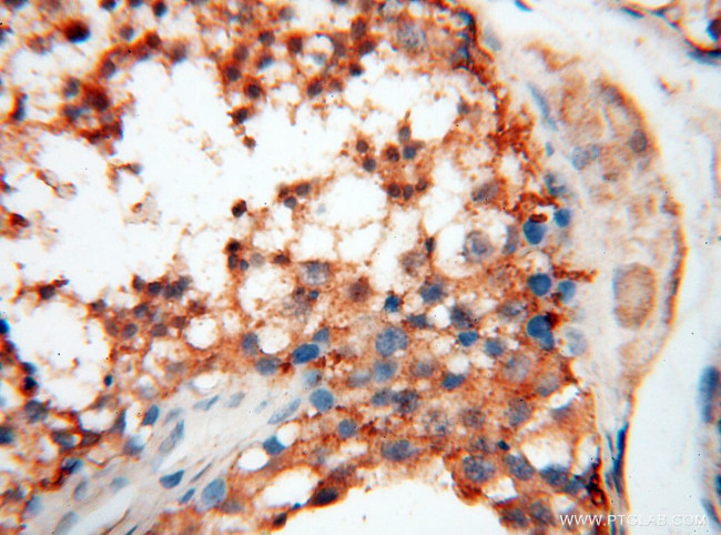 USP38 Antibody in Immunohistochemistry (Paraffin) (IHC (P))