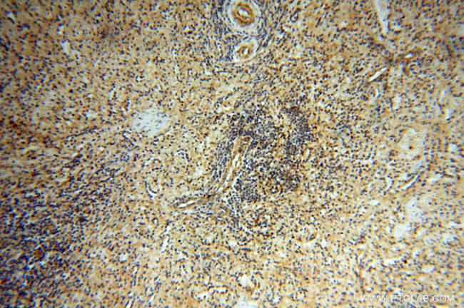 USP38 Antibody in Immunohistochemistry (Paraffin) (IHC (P))