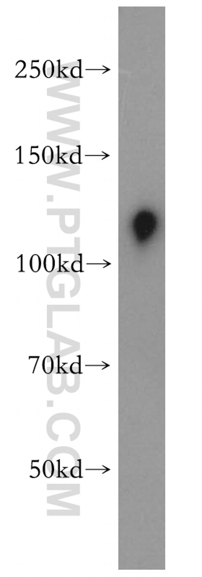 USP38 Antibody in Western Blot (WB)