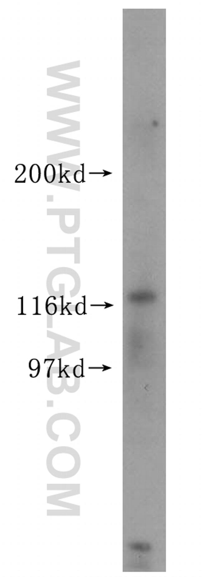 USP38 Antibody in Western Blot (WB)