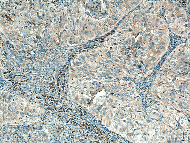 MYO1E Antibody in Immunohistochemistry (Paraffin) (IHC (P))