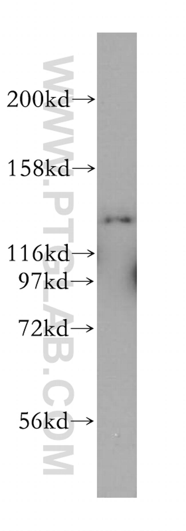 MYO1E Antibody in Western Blot (WB)