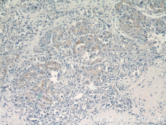 BMP9 Antibody in Immunohistochemistry (Paraffin) (IHC (P))