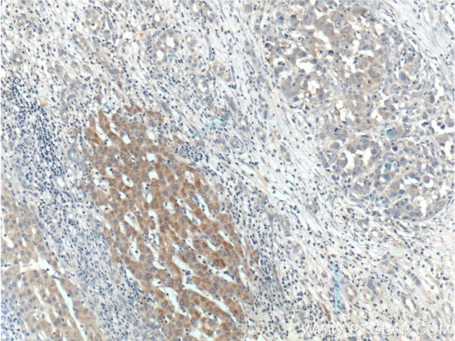 BMP9 Antibody in Immunohistochemistry (Paraffin) (IHC (P))