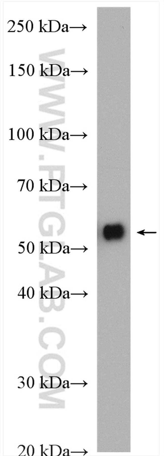 CACNB4 Antibody in Western Blot (WB)