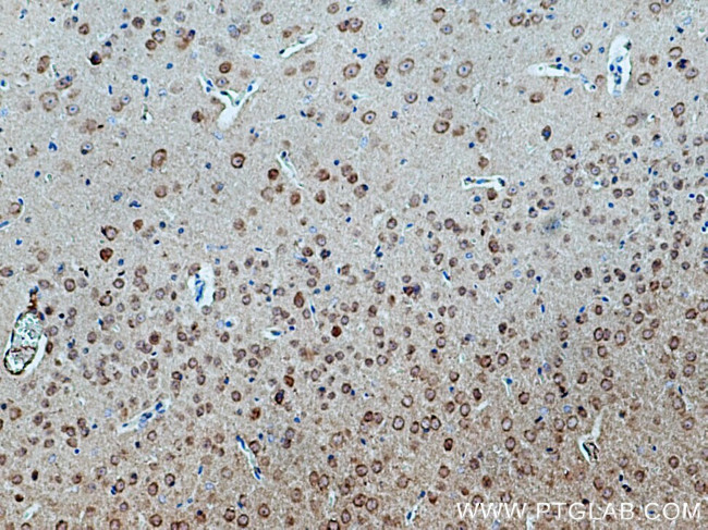 CACNB4 Antibody in Immunohistochemistry (Paraffin) (IHC (P))