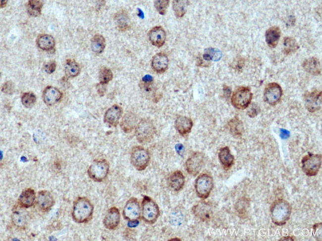 CACNB4 Antibody in Immunohistochemistry (Paraffin) (IHC (P))