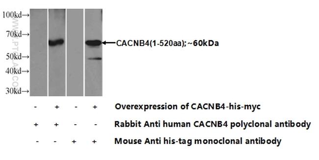 CACNB4 Antibody in Western Blot (WB)