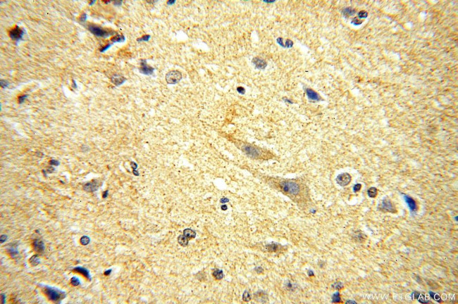 PDE7B Antibody in Immunohistochemistry (Paraffin) (IHC (P))