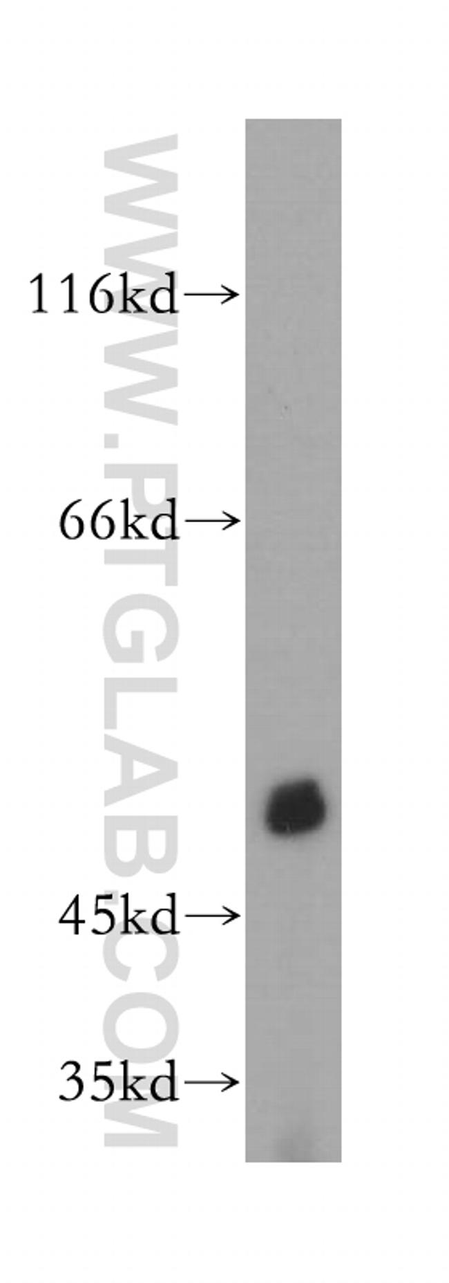 PDE7B Antibody in Western Blot (WB)