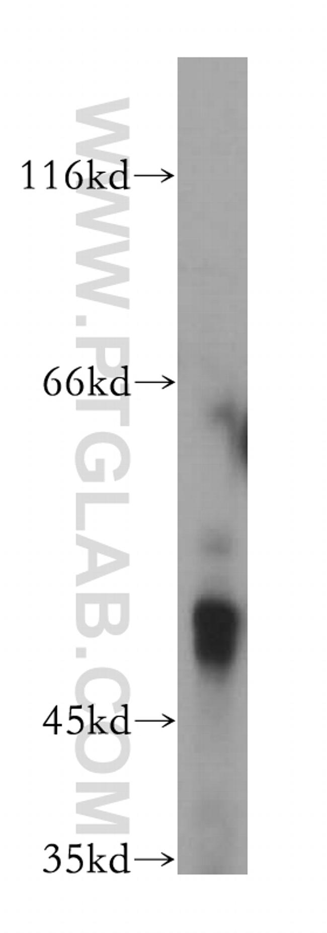 PDE7B Antibody in Western Blot (WB)