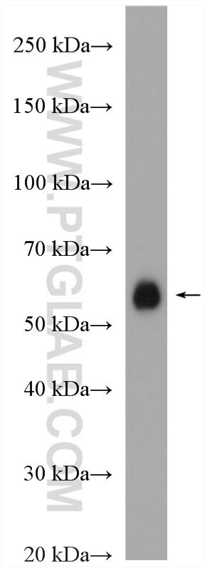 NOX1 Antibody in Western Blot (WB)