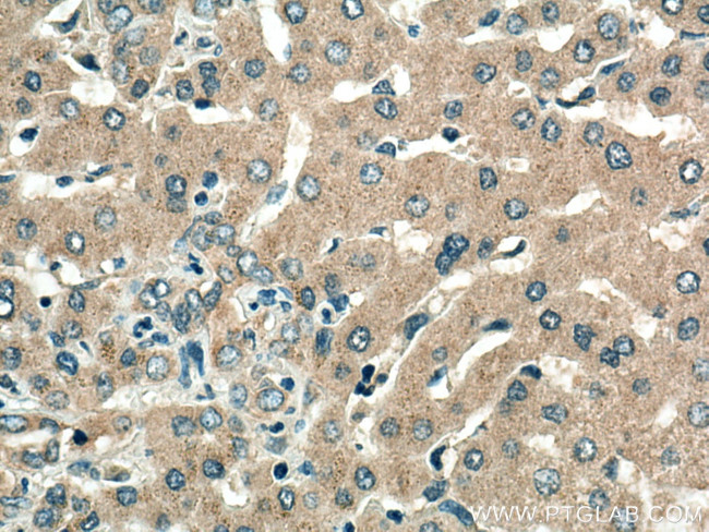 VPS16 Antibody in Immunohistochemistry (Paraffin) (IHC (P))