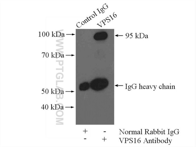 VPS16 Antibody in Immunoprecipitation (IP)