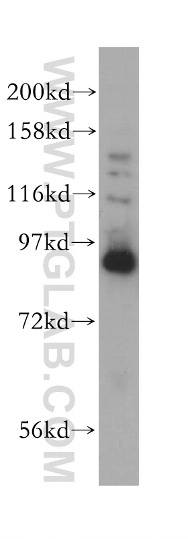 VPS16 Antibody in Western Blot (WB)