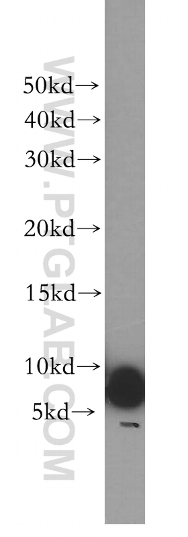 UCRC Antibody in Western Blot (WB)