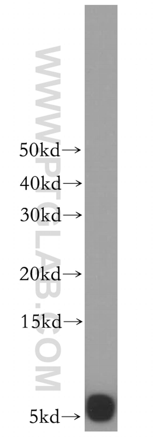 UCRC Antibody in Western Blot (WB)