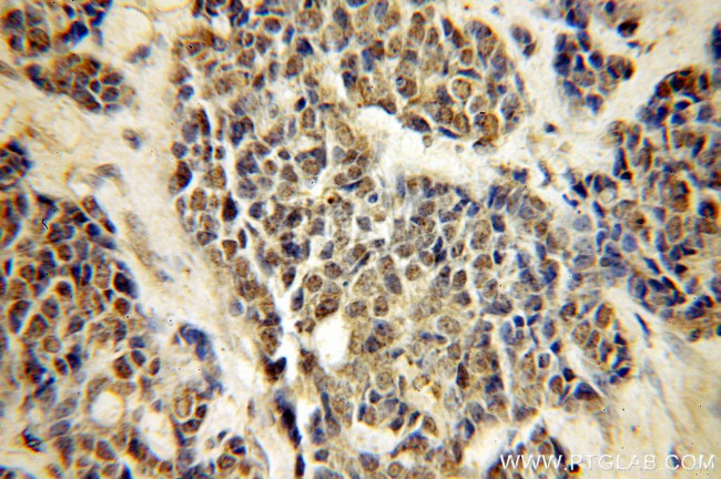 ORC6 Antibody in Immunohistochemistry (Paraffin) (IHC (P))