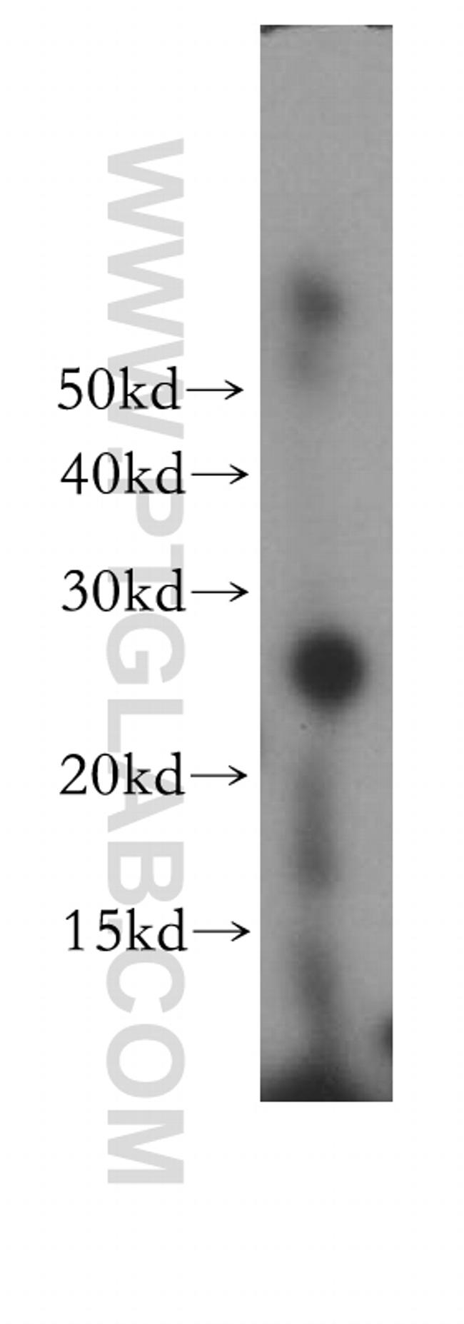 ORC6 Antibody in Western Blot (WB)