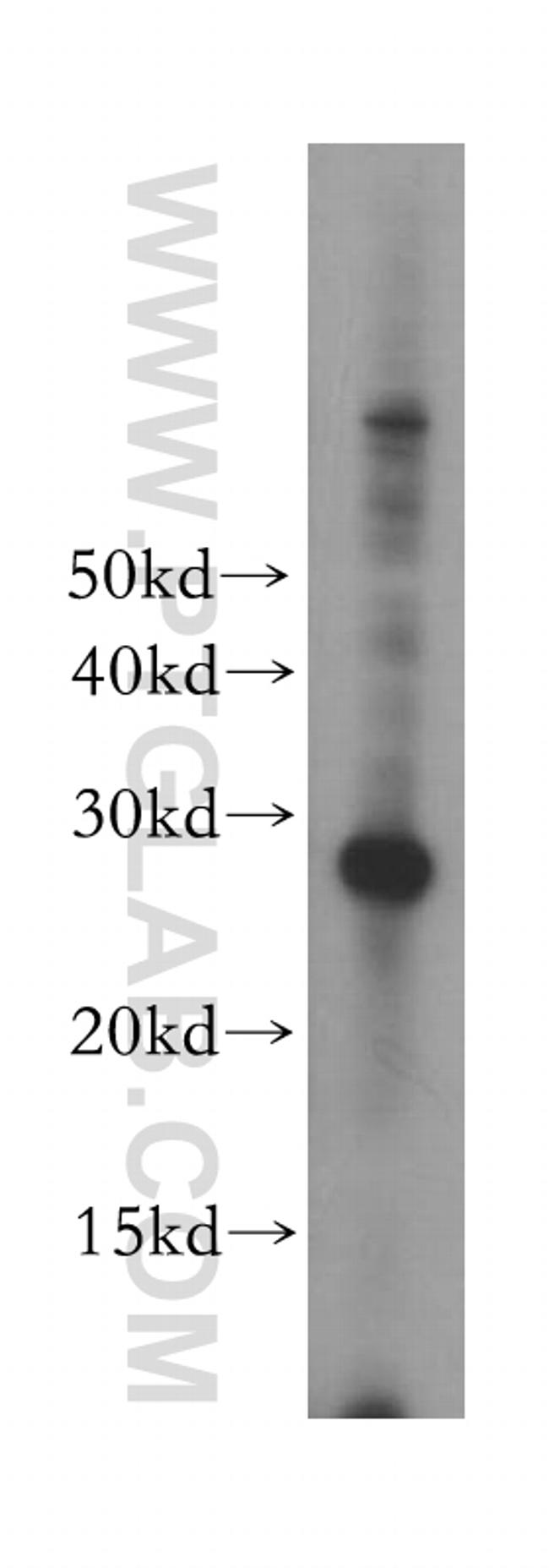 ORC6 Antibody in Western Blot (WB)