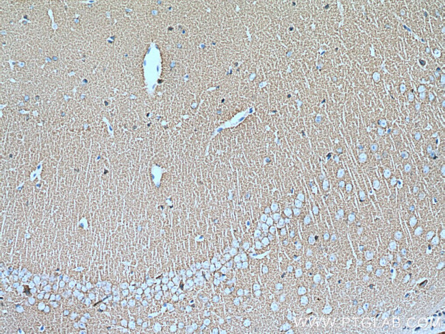 Synaptophysin Antibody in Immunohistochemistry (Paraffin) (IHC (P))