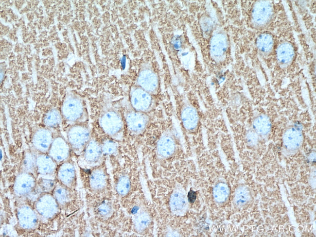 Synaptophysin Antibody in Immunohistochemistry (Paraffin) (IHC (P))