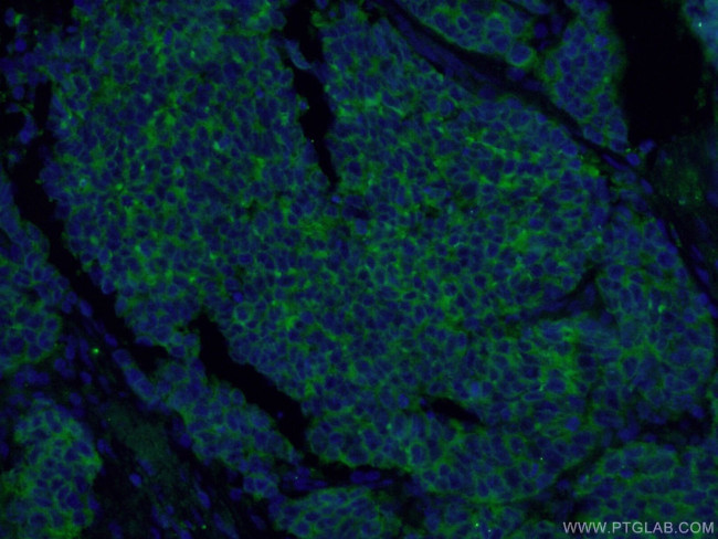 Synaptophysin Antibody in Immunohistochemistry (PFA fixed) (IHC (PFA))