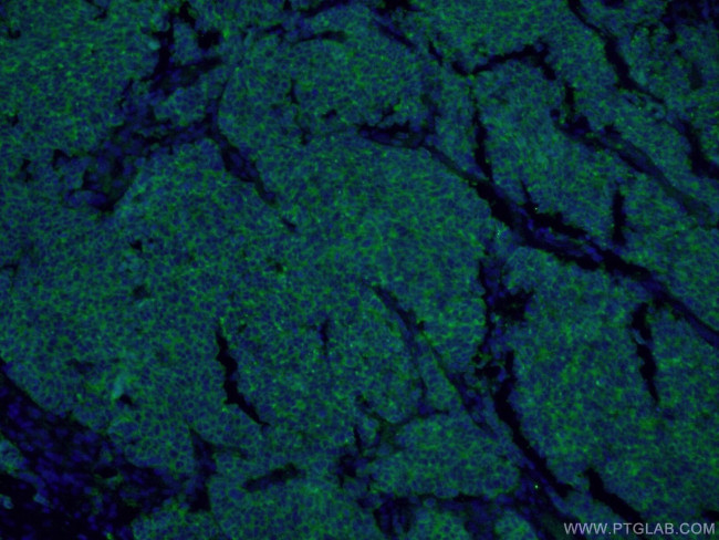 Synaptophysin Antibody in Immunohistochemistry (PFA fixed) (IHC (PFA))