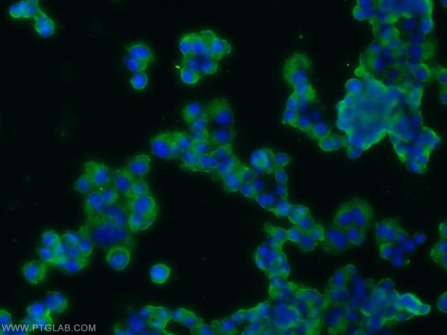 Synaptophysin Antibody in Immunocytochemistry (ICC/IF)