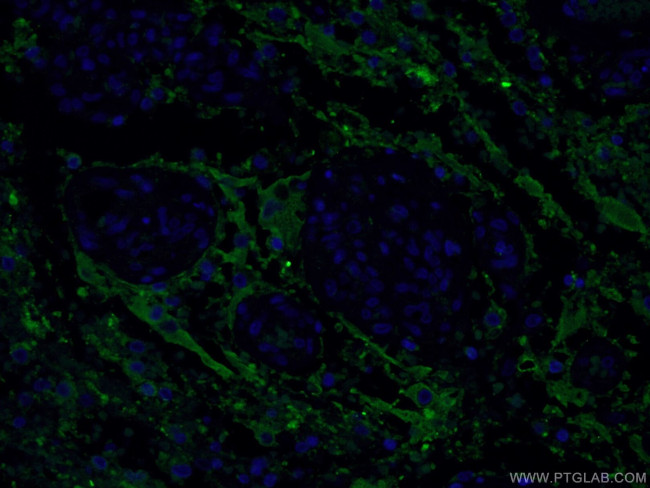 Synaptophysin Antibody in Immunohistochemistry (PFA fixed) (IHC (PFA))