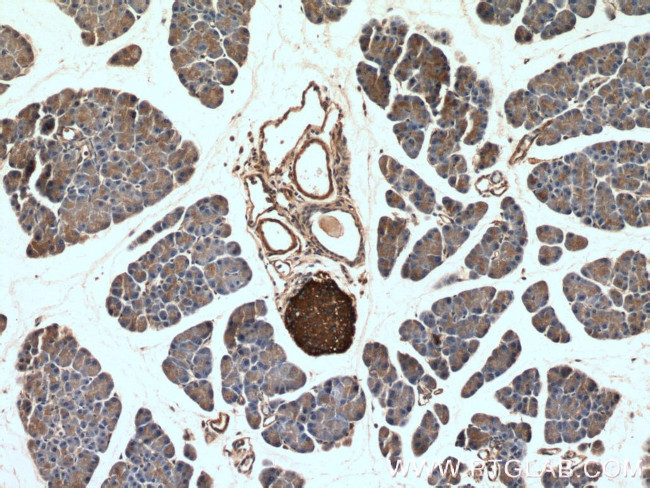 Synaptophysin Antibody in Immunohistochemistry (Paraffin) (IHC (P))