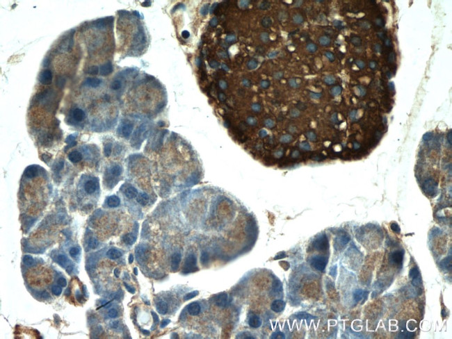 Synaptophysin Antibody in Immunohistochemistry (Paraffin) (IHC (P))