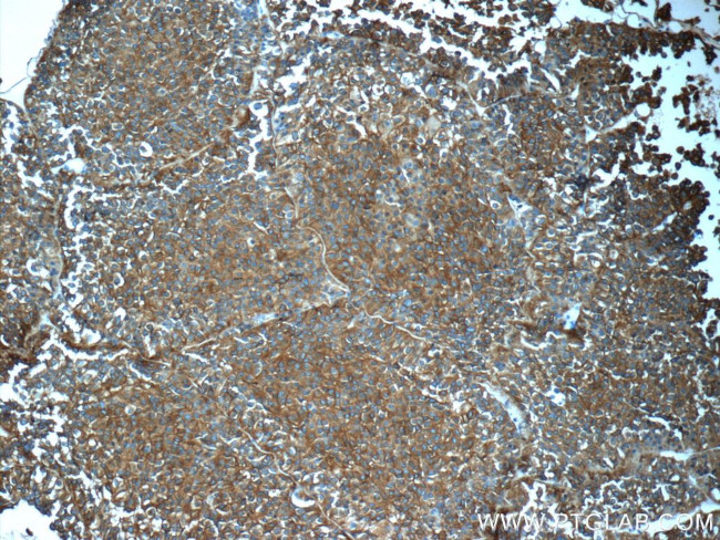 Synaptophysin Antibody in Immunohistochemistry (Paraffin) (IHC (P))