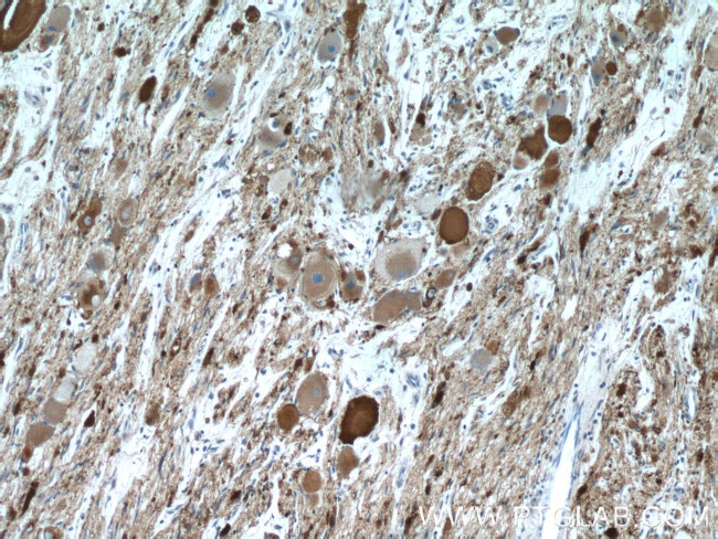 Synaptophysin Antibody in Immunohistochemistry (Paraffin) (IHC (P))