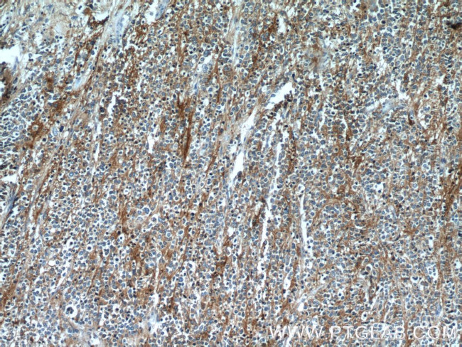 Synaptophysin Antibody in Immunohistochemistry (Paraffin) (IHC (P))