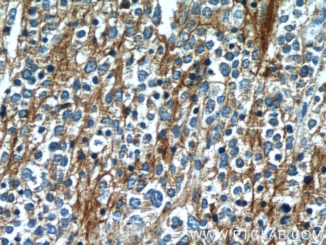 Synaptophysin Antibody in Immunohistochemistry (Paraffin) (IHC (P))