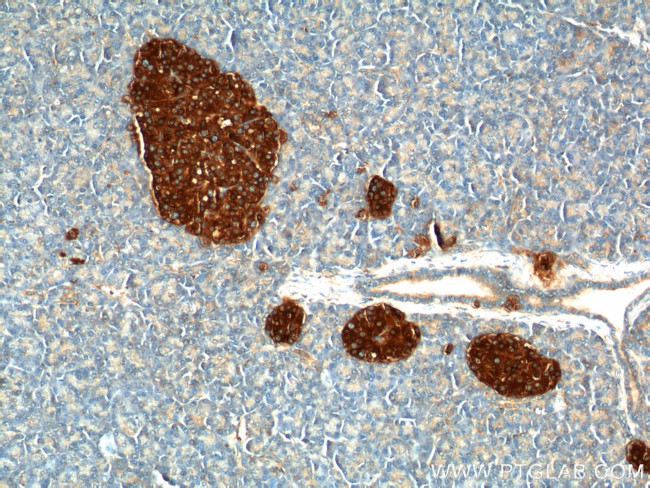 Synaptophysin Antibody in Immunohistochemistry (Paraffin) (IHC (P))