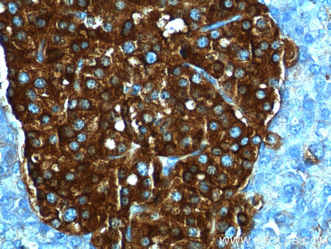 Synaptophysin Antibody in Immunohistochemistry (Paraffin) (IHC (P))