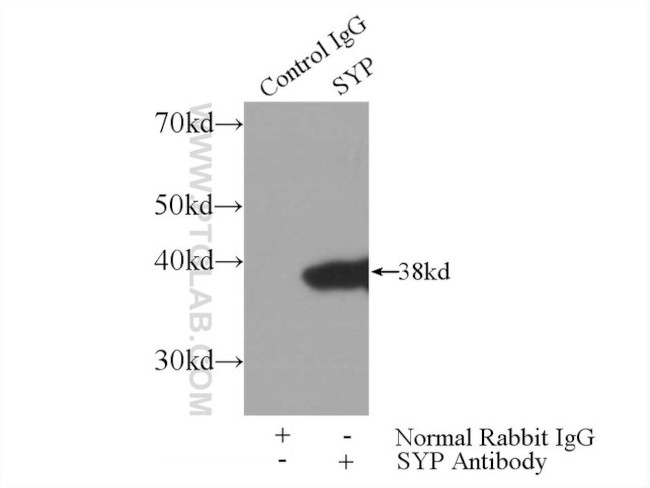 Synaptophysin Antibody in Immunoprecipitation (IP)