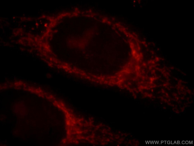 MAPKBP1 Antibody in Immunocytochemistry (ICC/IF)