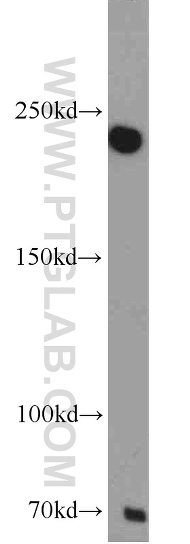 MAPKBP1 Antibody in Western Blot (WB)