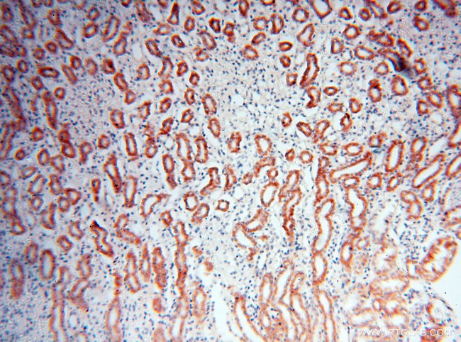 ANT1/2 Antibody in Immunohistochemistry (Paraffin) (IHC (P))